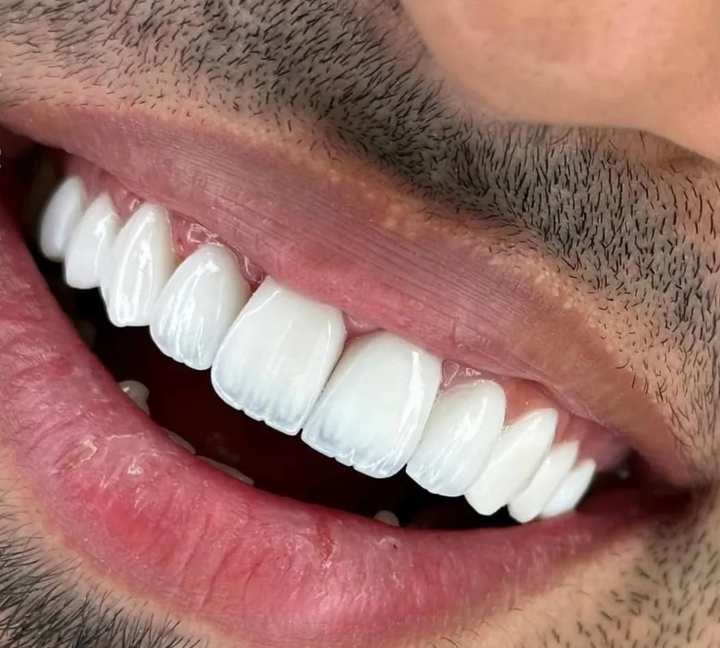 Nova Dental Clinics — صورة 6