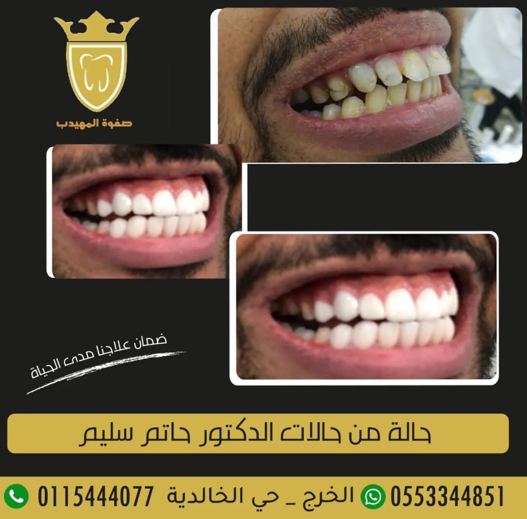 صفوة المهيدب لطب الأسنان الخرج حي الخالدية — صورة 6