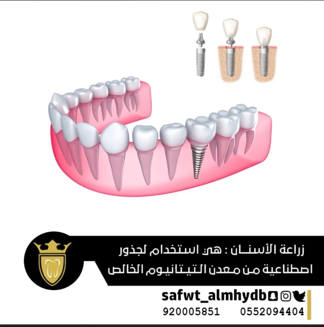 صفوة المهيدب لطب الأسنان الخرج حي الخالدية — صورة 8