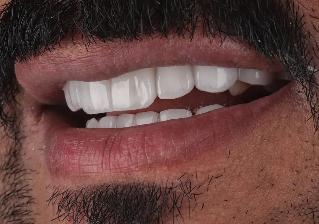 صفوة المهيدب لطب الاسنان الدمام حي الجلوية — صورة 4