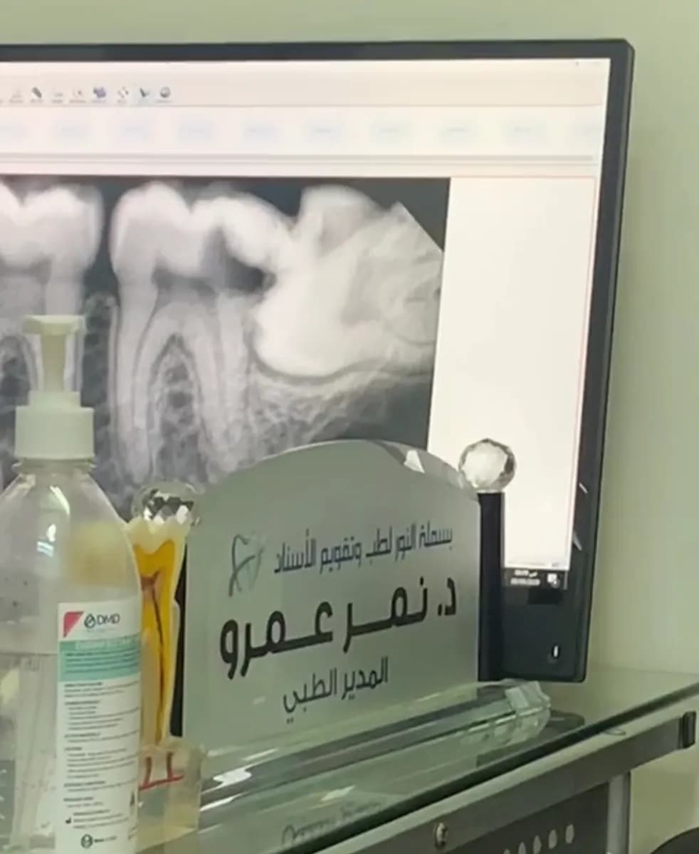بسملة النور لطب وتقويم الاسنان Basamalh Al noor dental center — صورة 6