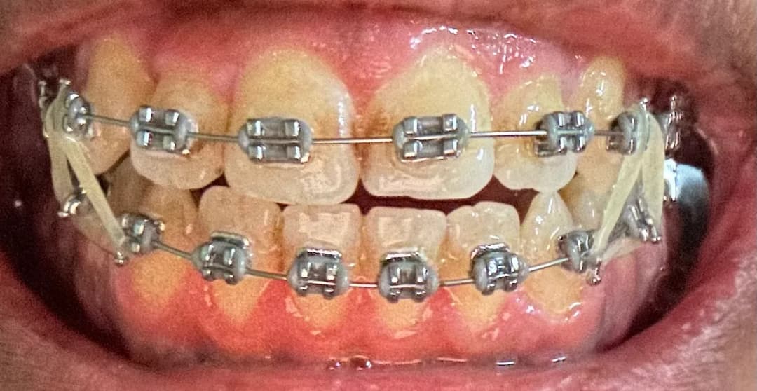 صفوة المهيدب لطب الاسنان الجبيل — صورة 5