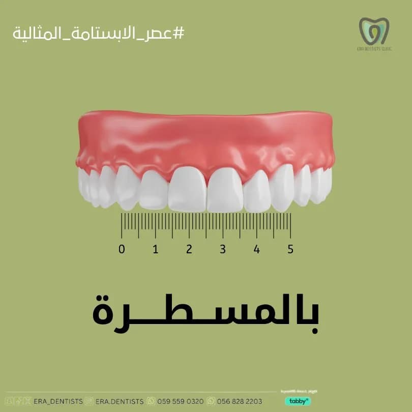 مجمع عيادات أطباء العصر لطب الأسنان( زراعة الأسنان - تقويم الأسنان - تجميل الأسنان - علاج العصب و الجذور - طب أسنان الأطفال) — صورة 4