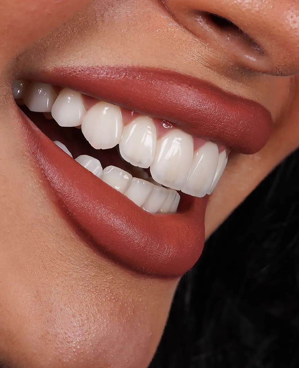 عيادات هارموني سمايل كلينيك — صورة 8