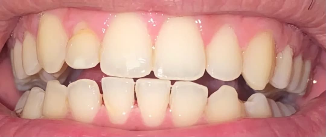 Smile Design Dental Clinics — صورة 6