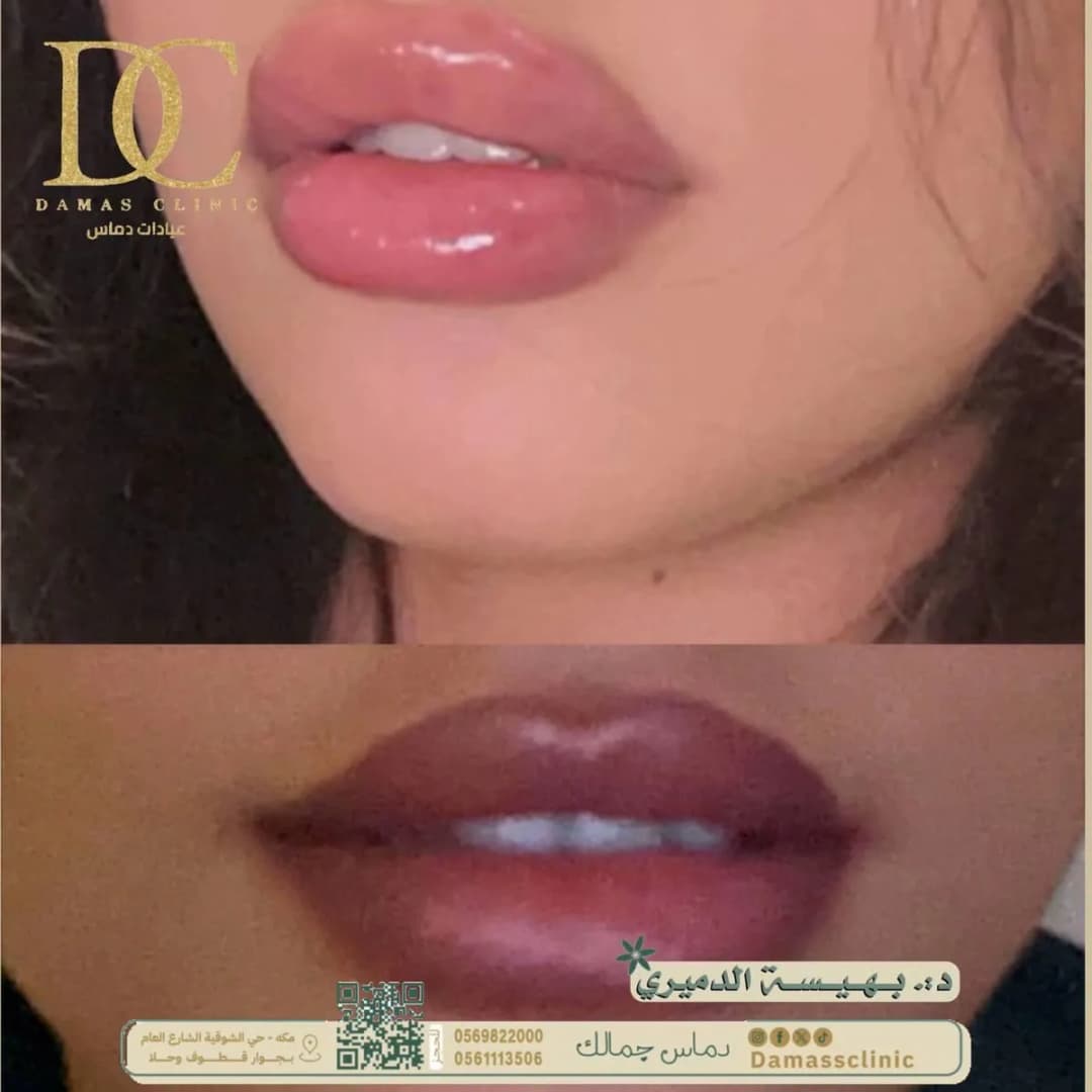 مجمع دماس العناية الطبي — صورة 6