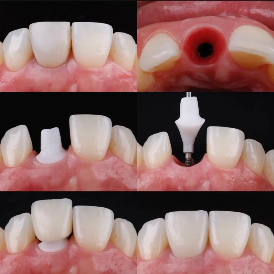 مينا لطب الأسنان | MINA Dental Clinic — صورة 4