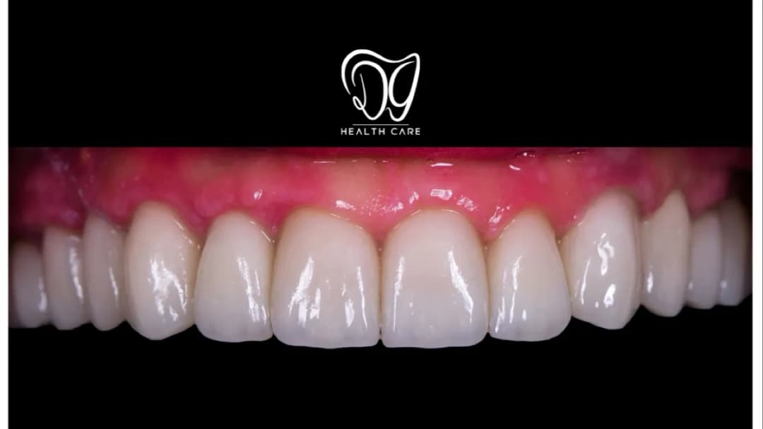 DG Health Care Turkey — Dental Clinics in Istanbul