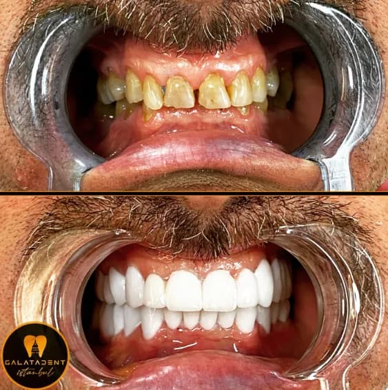 GalataDent Istanbul Diş Kliniği — Dental Clinics in Istanbul