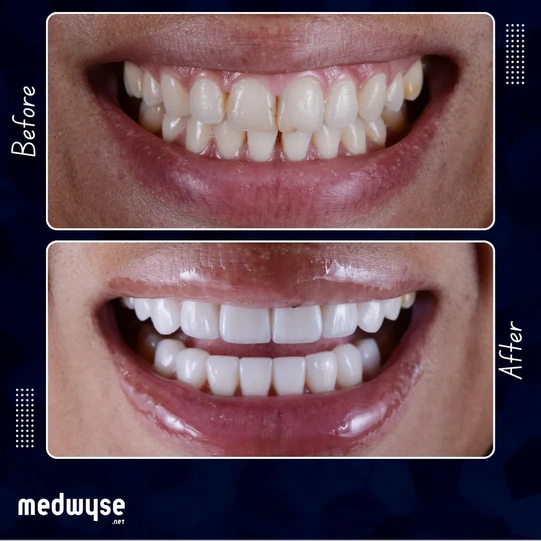 Medwyse — Cosmetic & Plastic Surgery in Istanbul