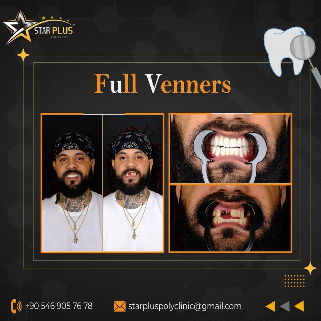 VS+Clinic | Premium Dental Clinic