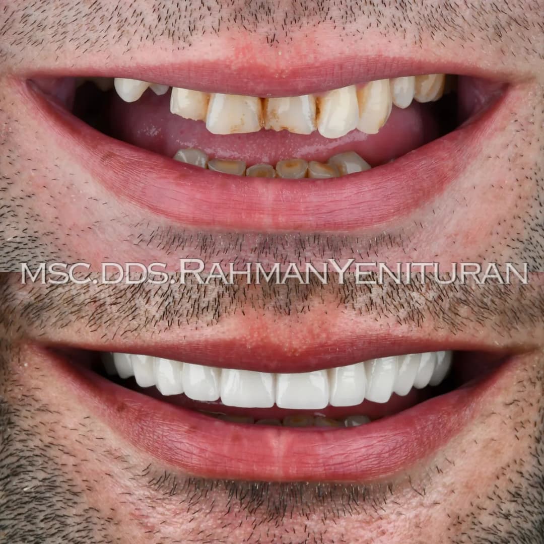 Salda Diş — Dental Clinics in Istanbul