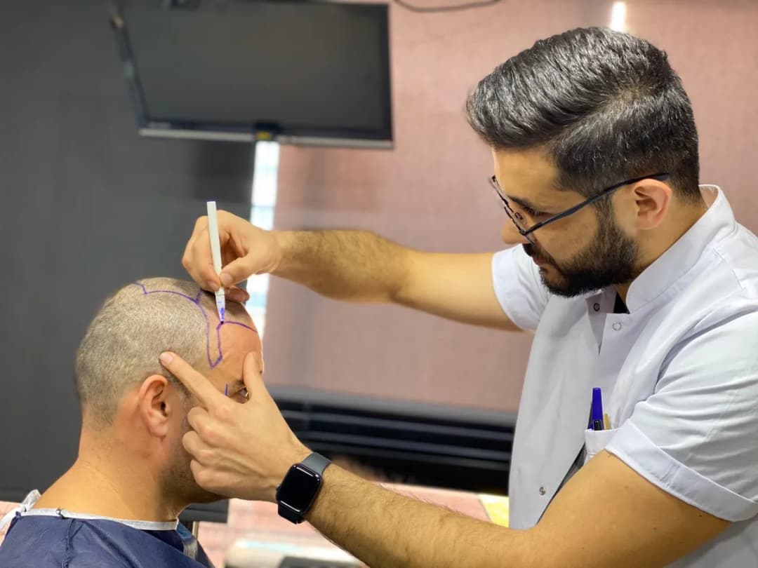 Master Hair Transplant