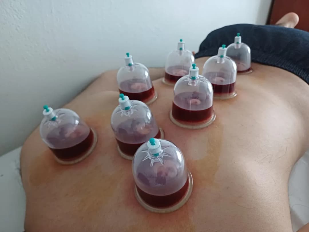 Bağcılar Hacamat Sülük — Alternative & Holistic Medicine in Istanbul