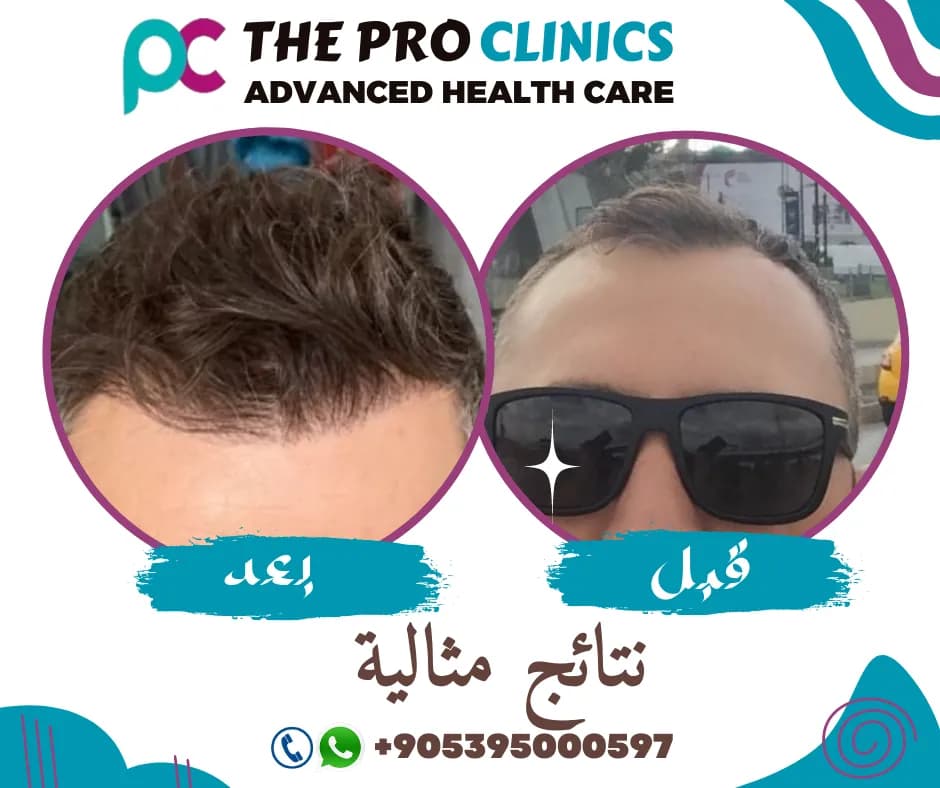 The Pro Clinics