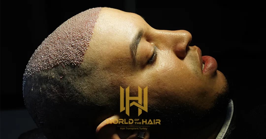 World Of The Hair — Dermatology & Skin Care in Istanbul