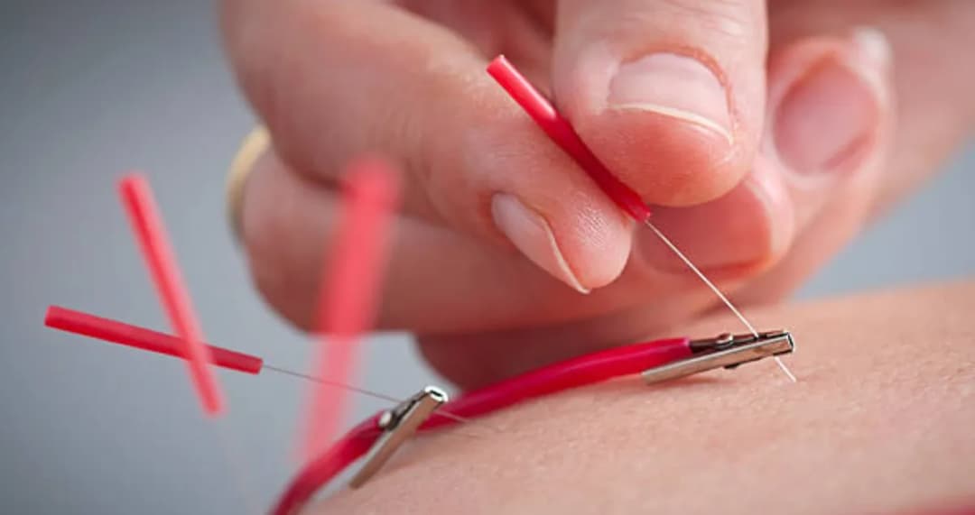 Uzm Dr Müslime Karaçınar Akupunktur Başakşehir — Alternative & Holistic Medicine in Istanbul