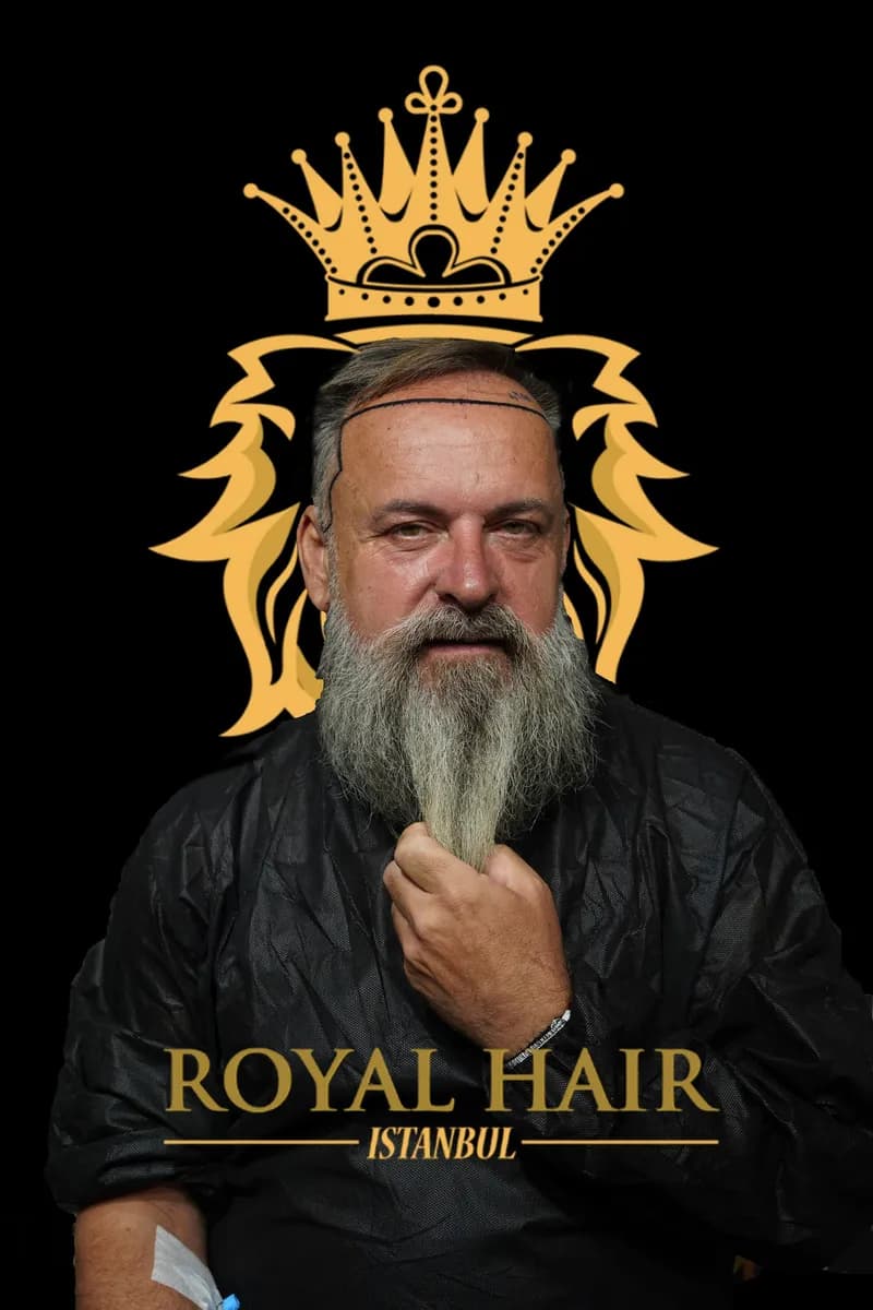 Royal Hair Istanbul | Hair Transplant Turkey — Dermatology & Skin Care in Istanbul