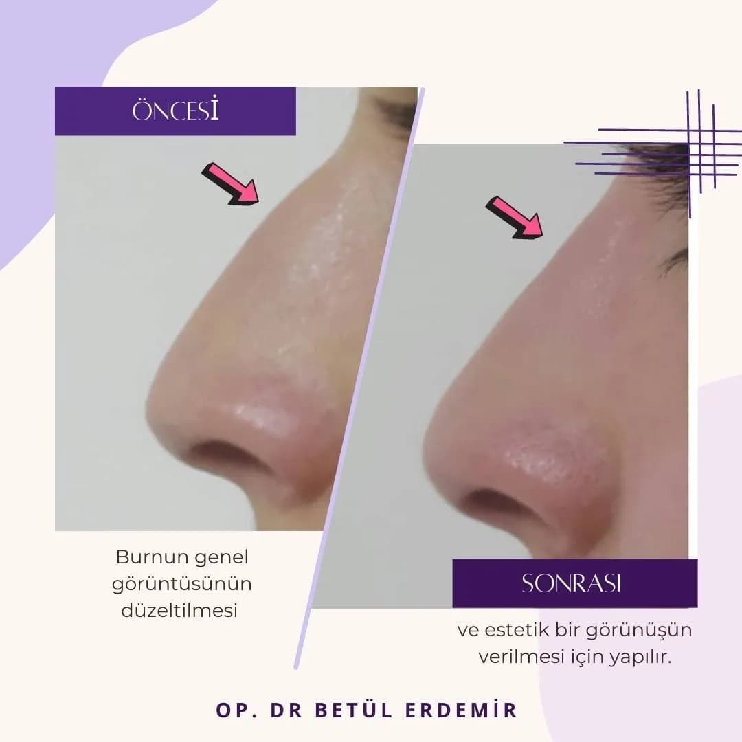 Plastderm — Cosmetic & Plastic Surgery in Istanbul