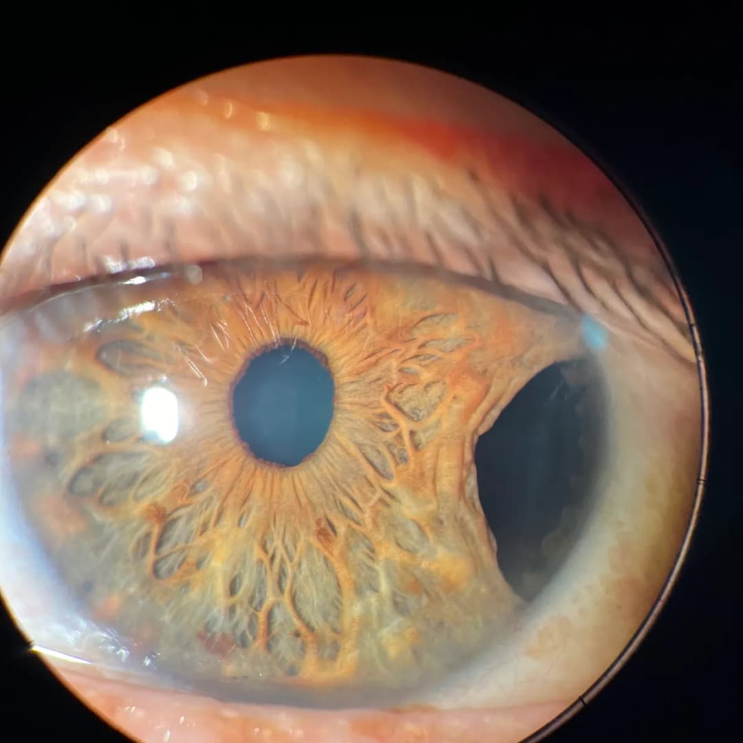 Op. Dr. Şükrü Sevinçli Göz Hastalıkları Uzmanı — Eye Care & Ophthalmology in Istanbul