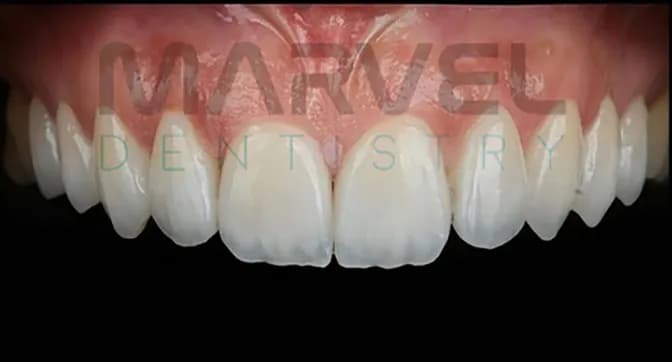 Marvel Dental Clinic — Dental Clinics in Istanbul