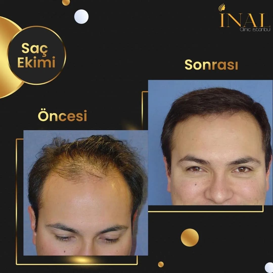 İnal Clinic
