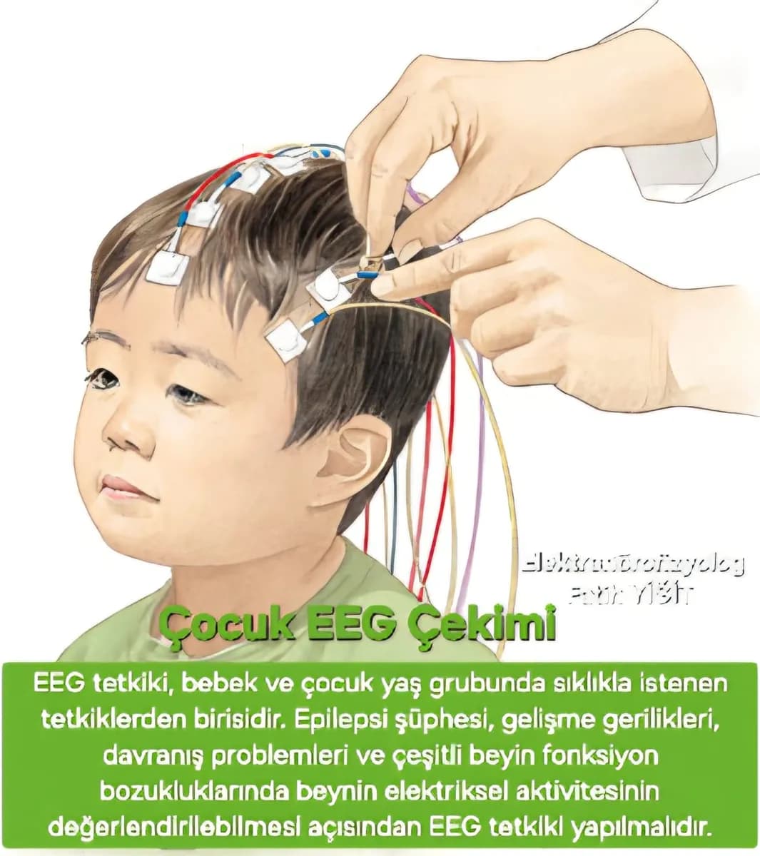Mobil Eeg