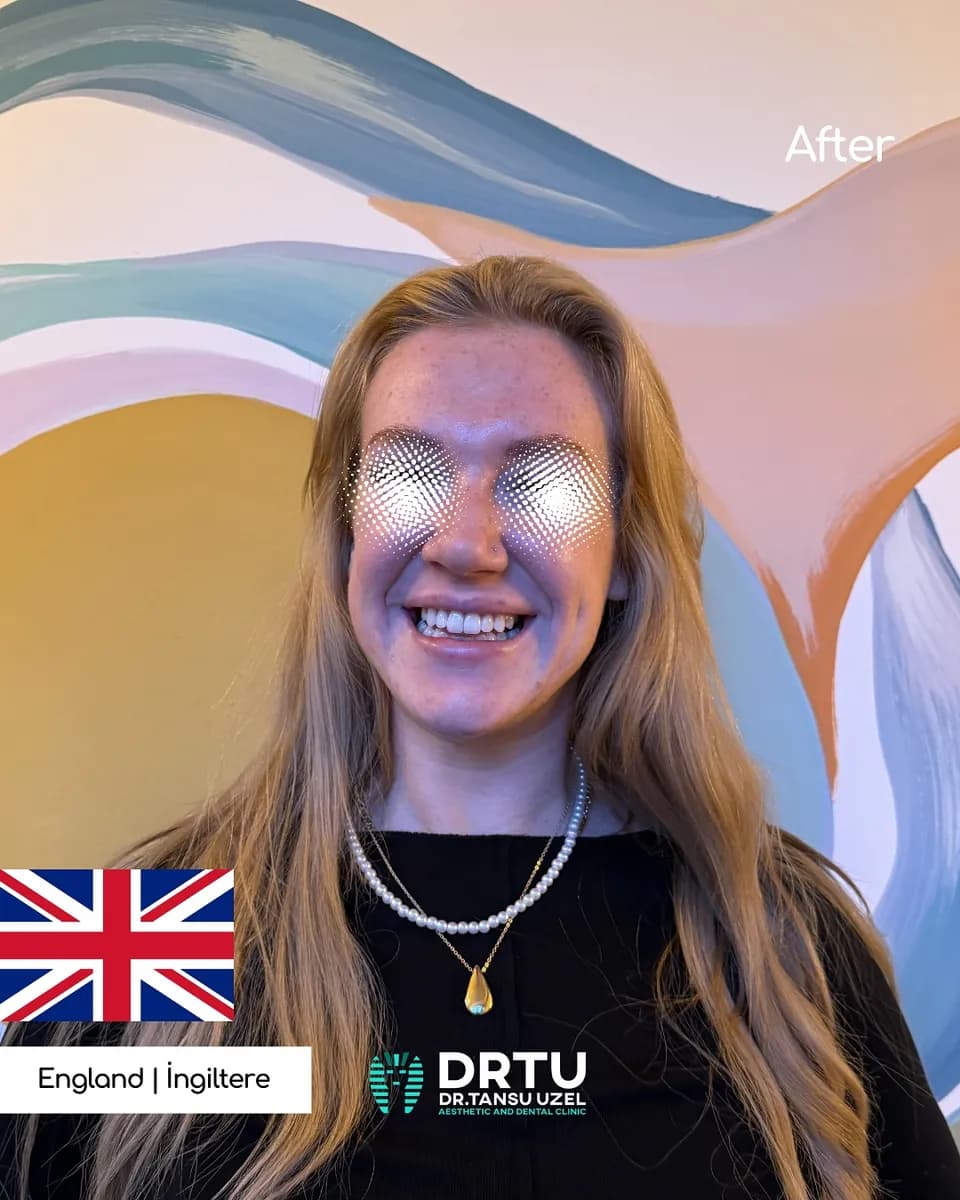 DRTU | DR. TANSU UZEL Dental Implant, Smile Design & Maxillofacial Surgery Istanbul — Dental Clinics in Istanbul