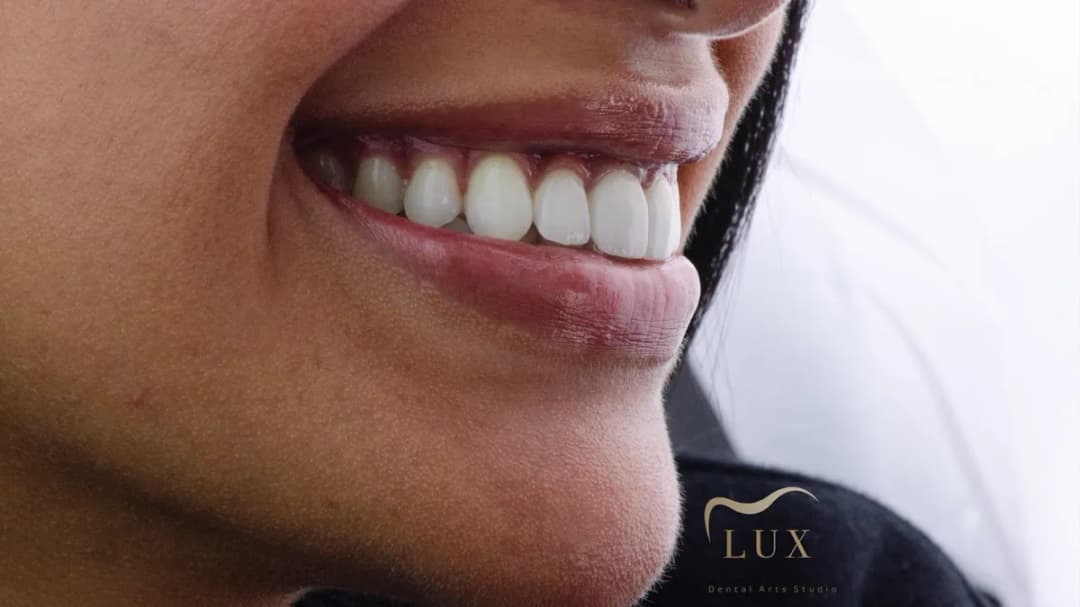 LUX Dental arts studio مركز لوكس لطب الاسنان