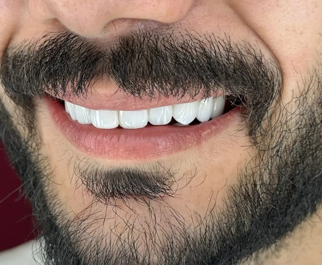 Royal crown clinic — Dental Clinics in Istanbul