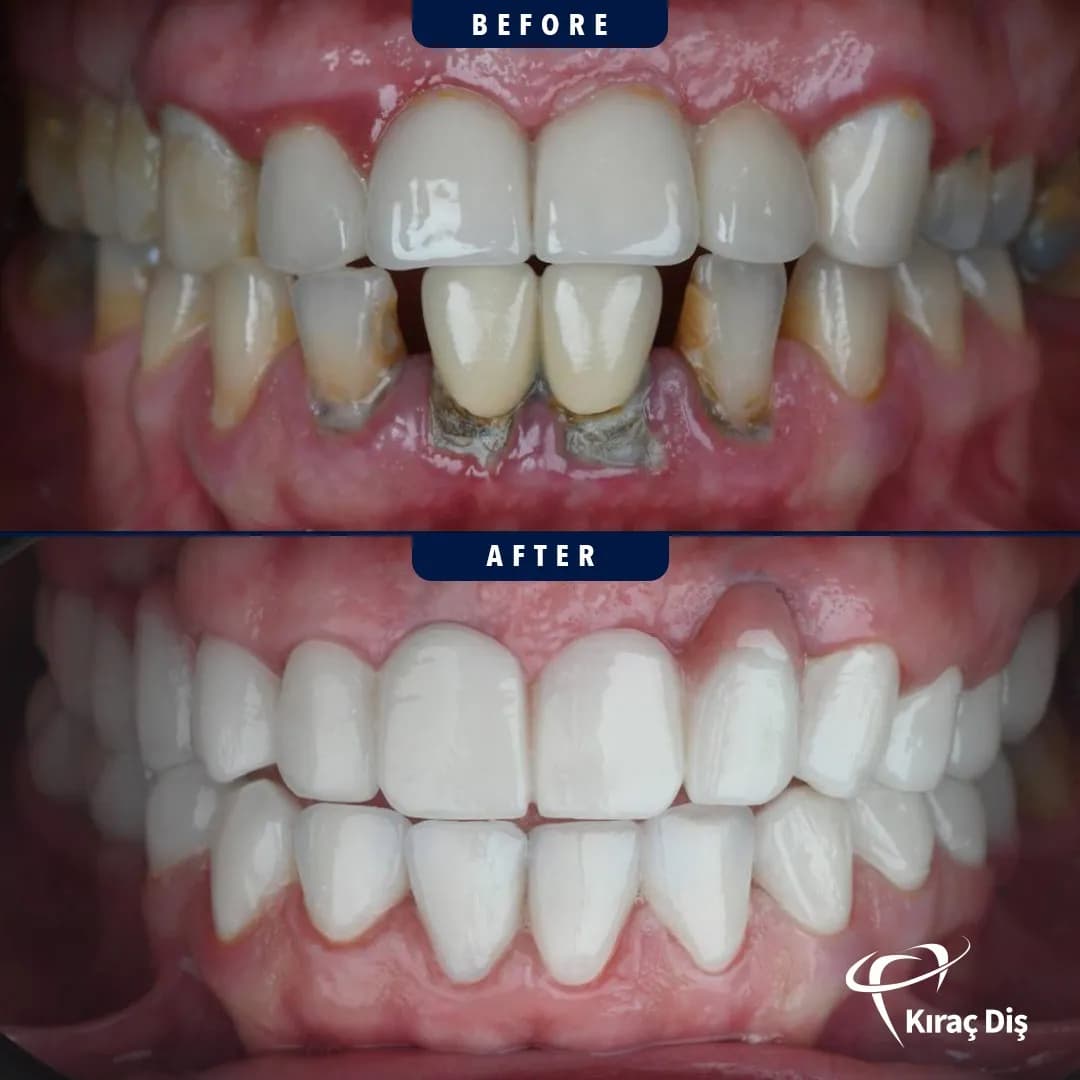 Özel Kıraç Dental Clinic — Dental Clinics in Istanbul