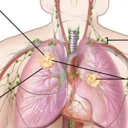 Prof. Dr. Burak Şakar, Tıbbi Onkoloji — Oncology & Cancer Care in Istanbul
