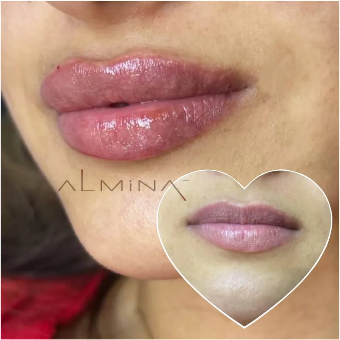 Almina clinic — Dermatology & Skin Care in Istanbul