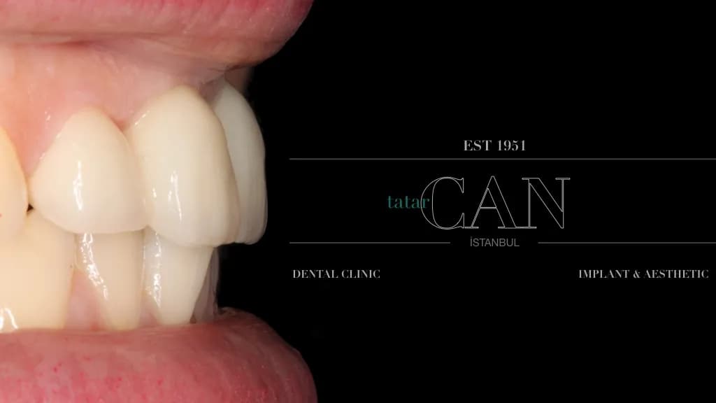 Dişhekimi Dr Can Tatar — Dental Clinics in Istanbul