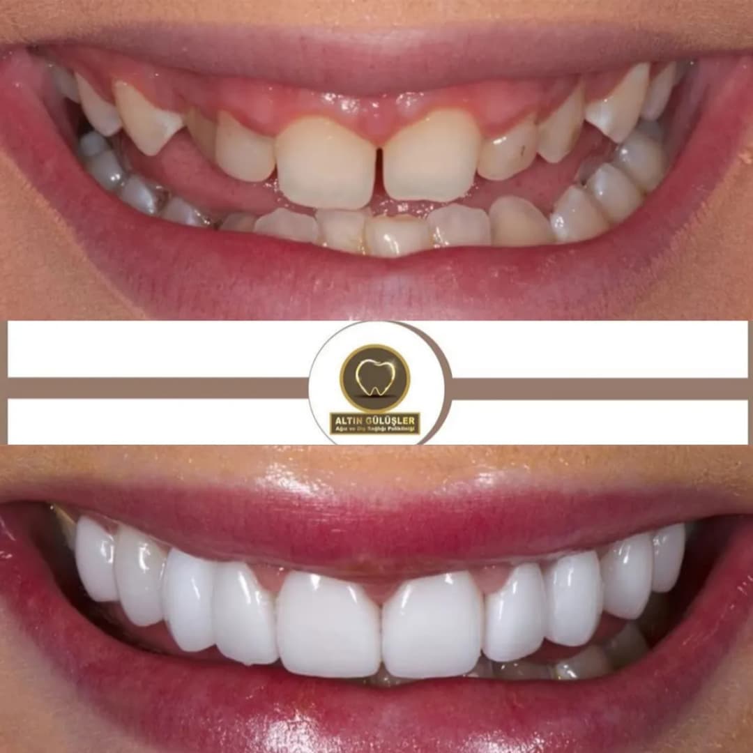 Golden Smile Basaksehir — Dental Clinics in Istanbul