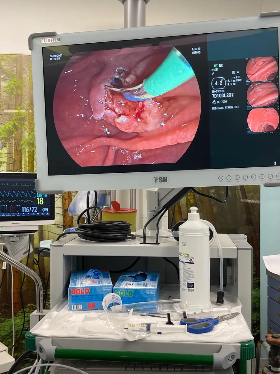 Prof. Dr. Ebubekir Şenateş — Gastroenterology & Digestive in Istanbul