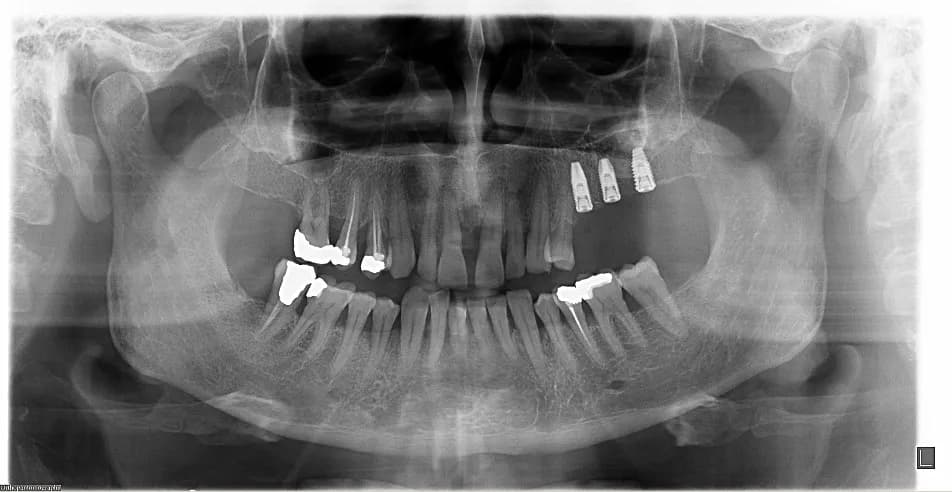 DİGİPAN MALTEPE Panoramik-Sefalometrik Röntgen 3 D Volumetrik Dental Tomografi — Radiology & Imaging in Istanbul