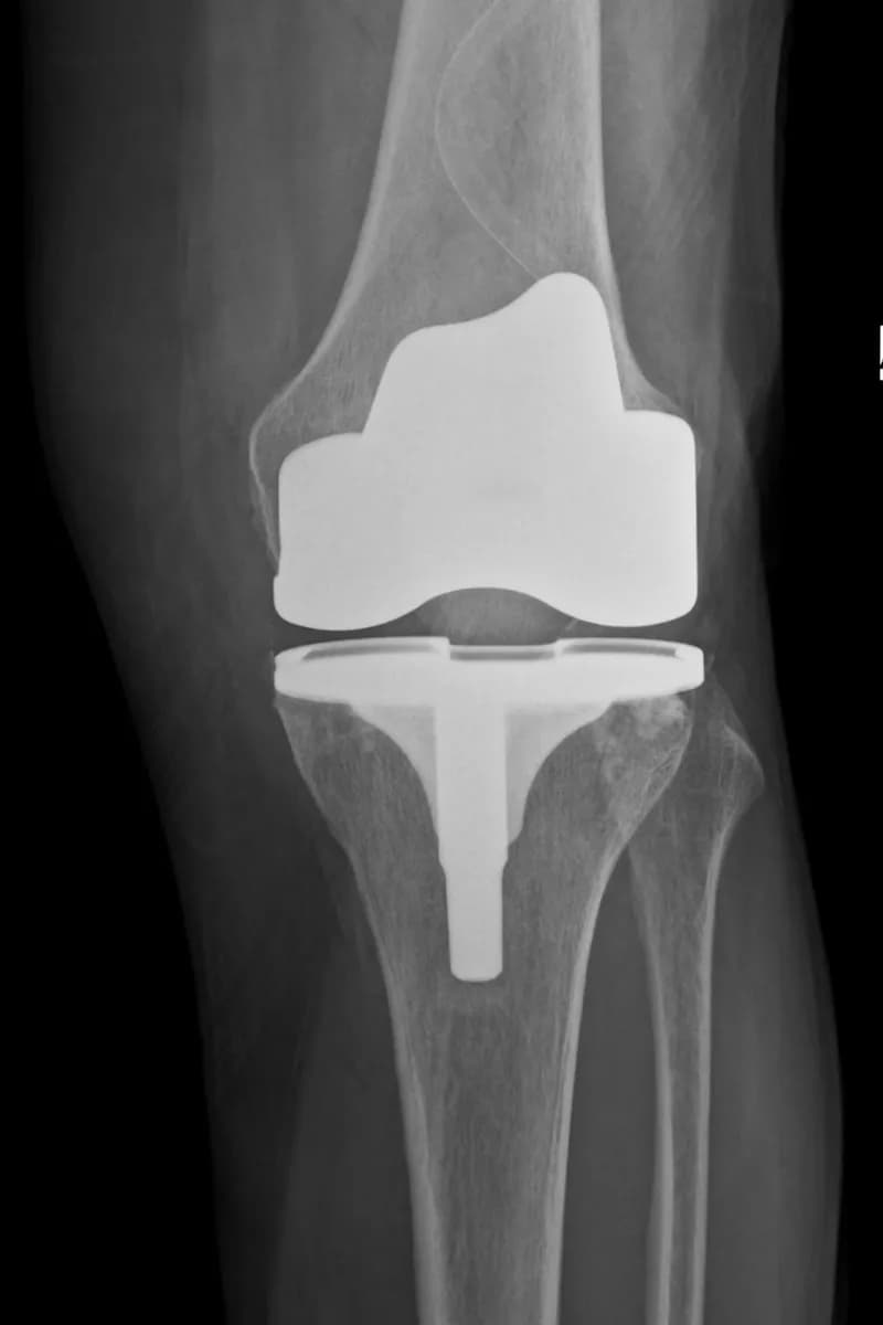 Ortopedi ve Travmatoloji Uzmanı - Op Dr Burak Abay — Orthopedics & Sports Medicine in Istanbul