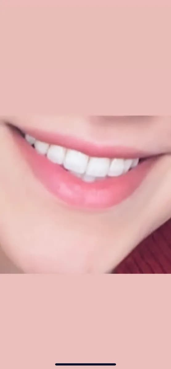 Healka — Dental Clinics in Istanbul