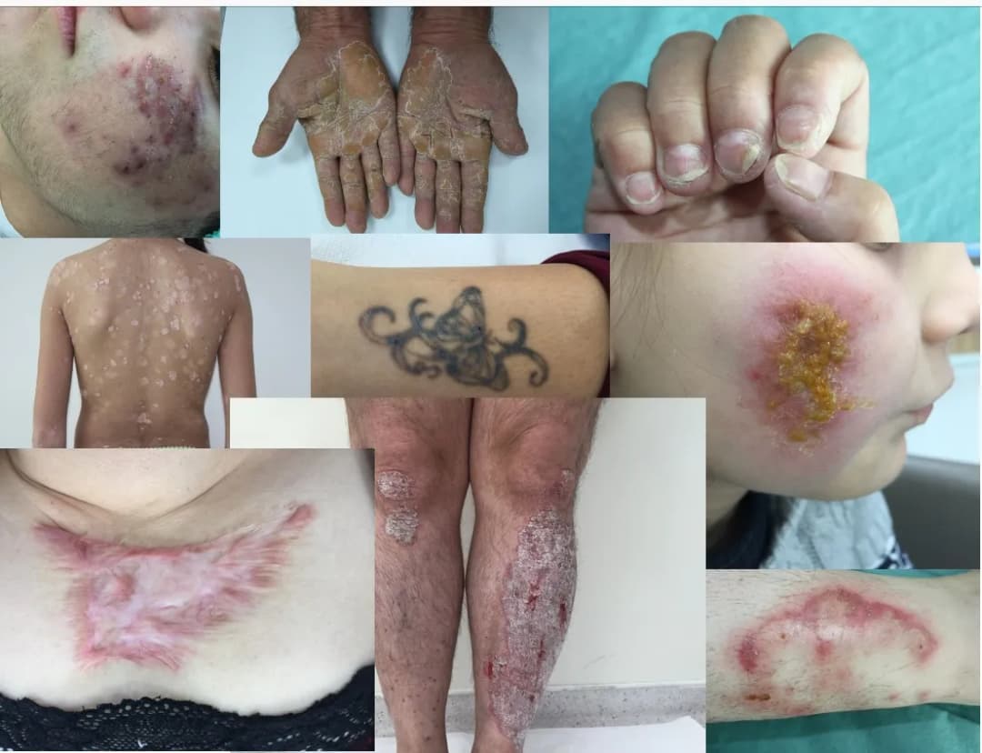Prof. Dr. Mustafa Özdemir, Dermatoloji — Dermatology & Skin Care in Istanbul