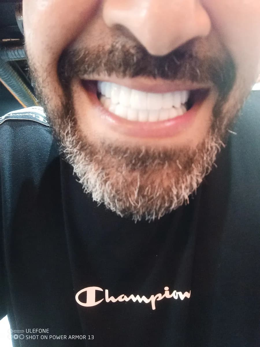 Donal Dent — Dental Clinics in Istanbul