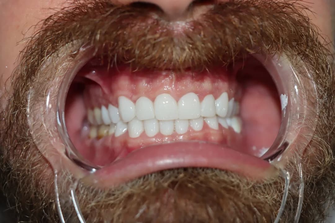 Yayla Dental Akademi Ağız ve Diş Sağlığı Polikliniği Bahçelievler/İstanbul — Dental Clinics in Istanbul