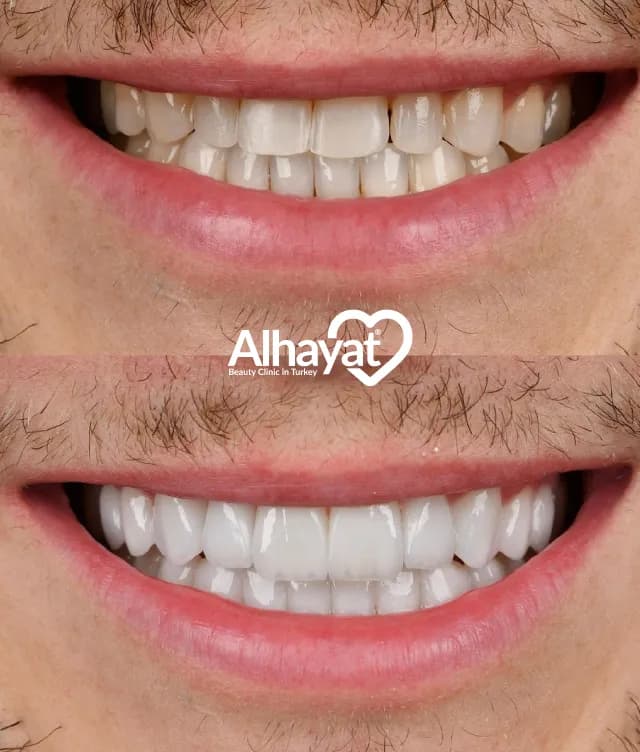 Alhayat clinic