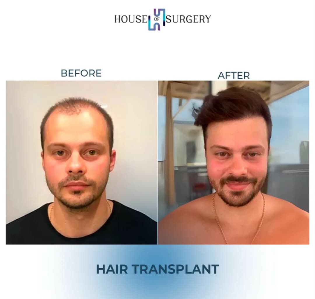 House of Surgery Turkey — Cosmetic & Plastic Surgery in Istanbul