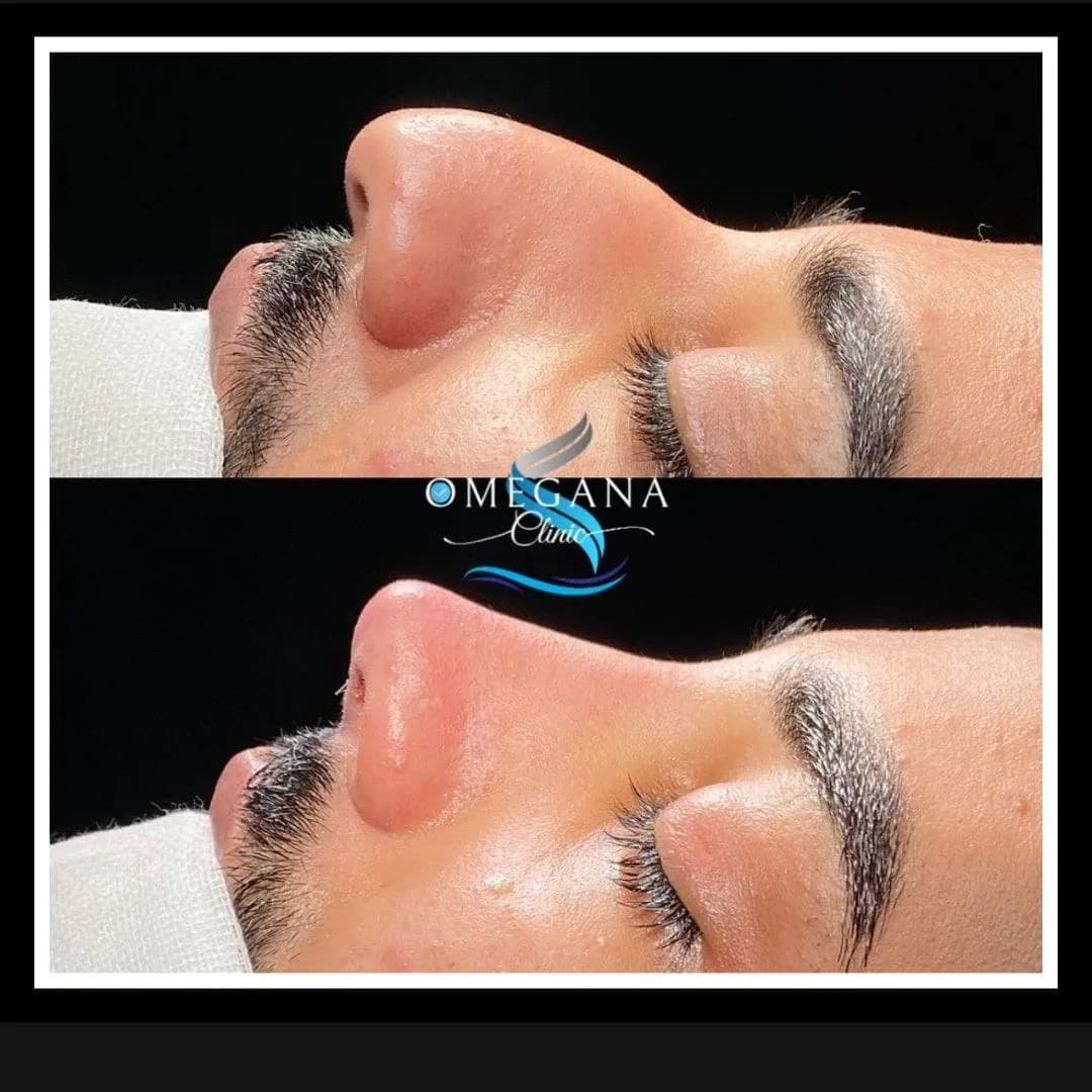 Omegana Clinic ( تجميل الأنف والجسم والأسنان )