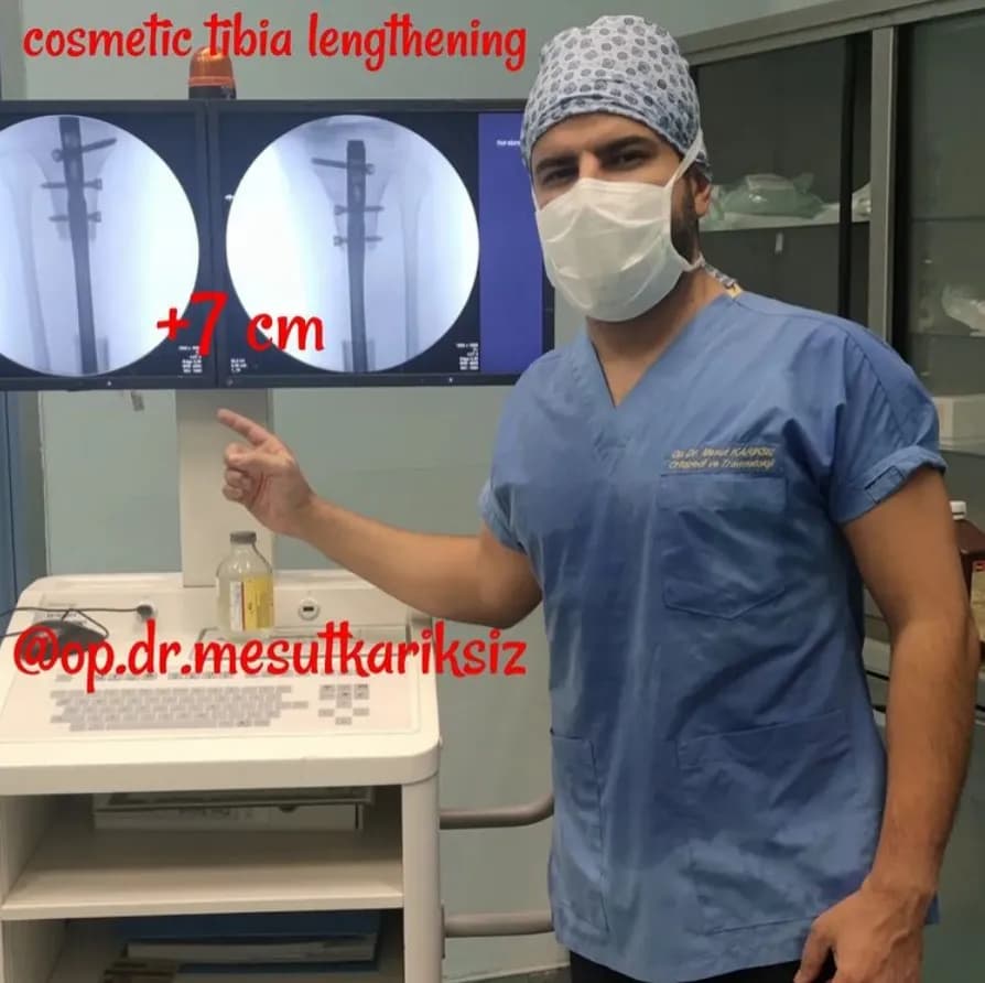 Leglengtheningturkey / Limb lengthening and deformity correction center — Orthopedics & Sports Medicine in Istanbul