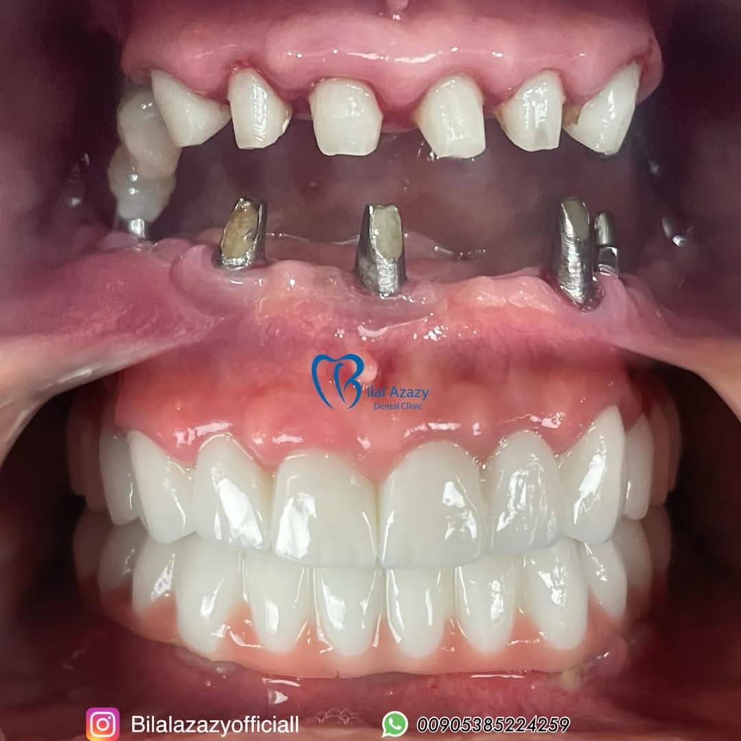 Dental Royal Clinic — Dental Clinics in Istanbul