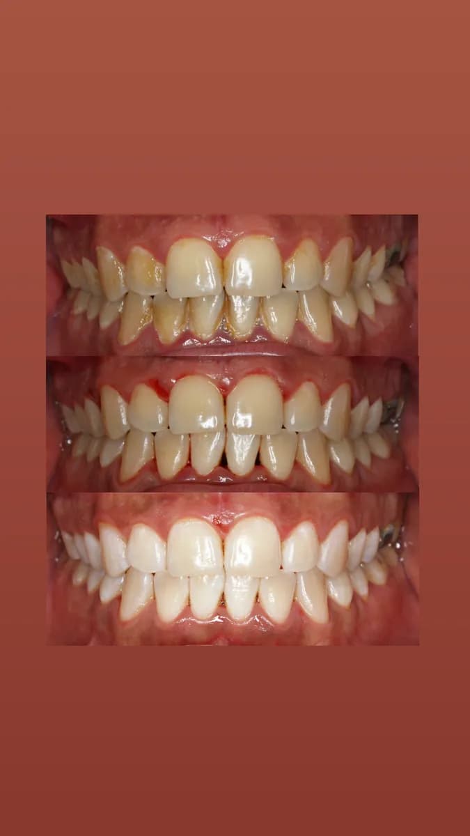 Ataşehir Ortodonti- Dr. Dt. Ece BÜYÜKBAŞARAN AKÇAY — Dental Clinics in Istanbul