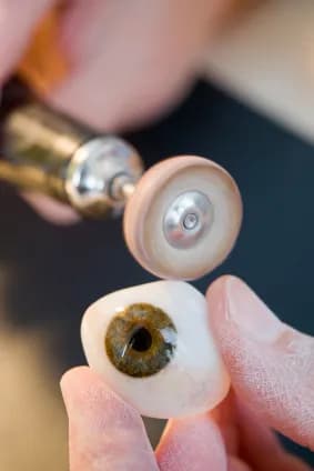 Prothèse Oculaire Turquie — Eye Care & Ophthalmology in Istanbul