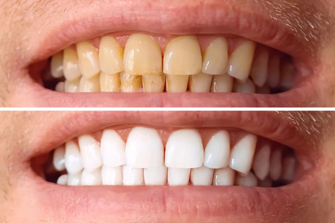 Inspire clinic — Cosmetic & Plastic Surgery in Istanbul